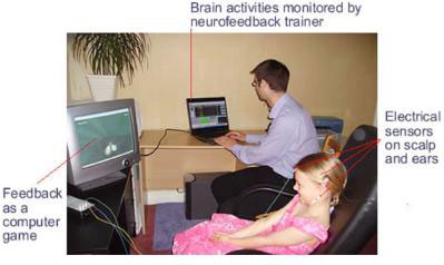 How neurofeedback works...